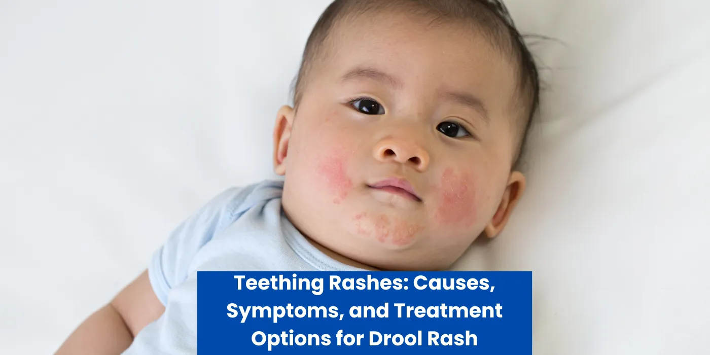 Teething Rashes: Causes, Symptoms, and Treatment Options for Drool Rash